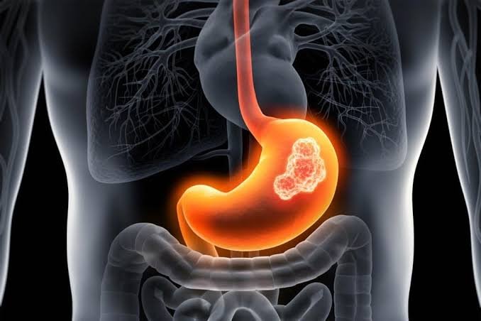 digestion